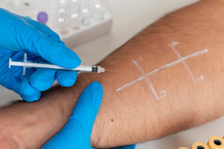 pruebas alergia alergologo